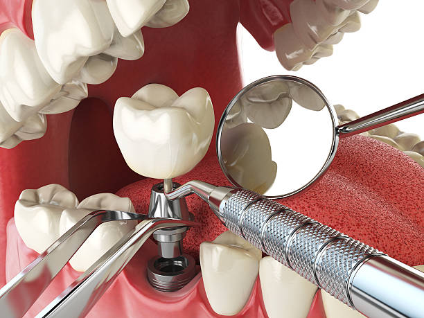 Best Emergency Orthodontic Repairs in Pennsboro, WV